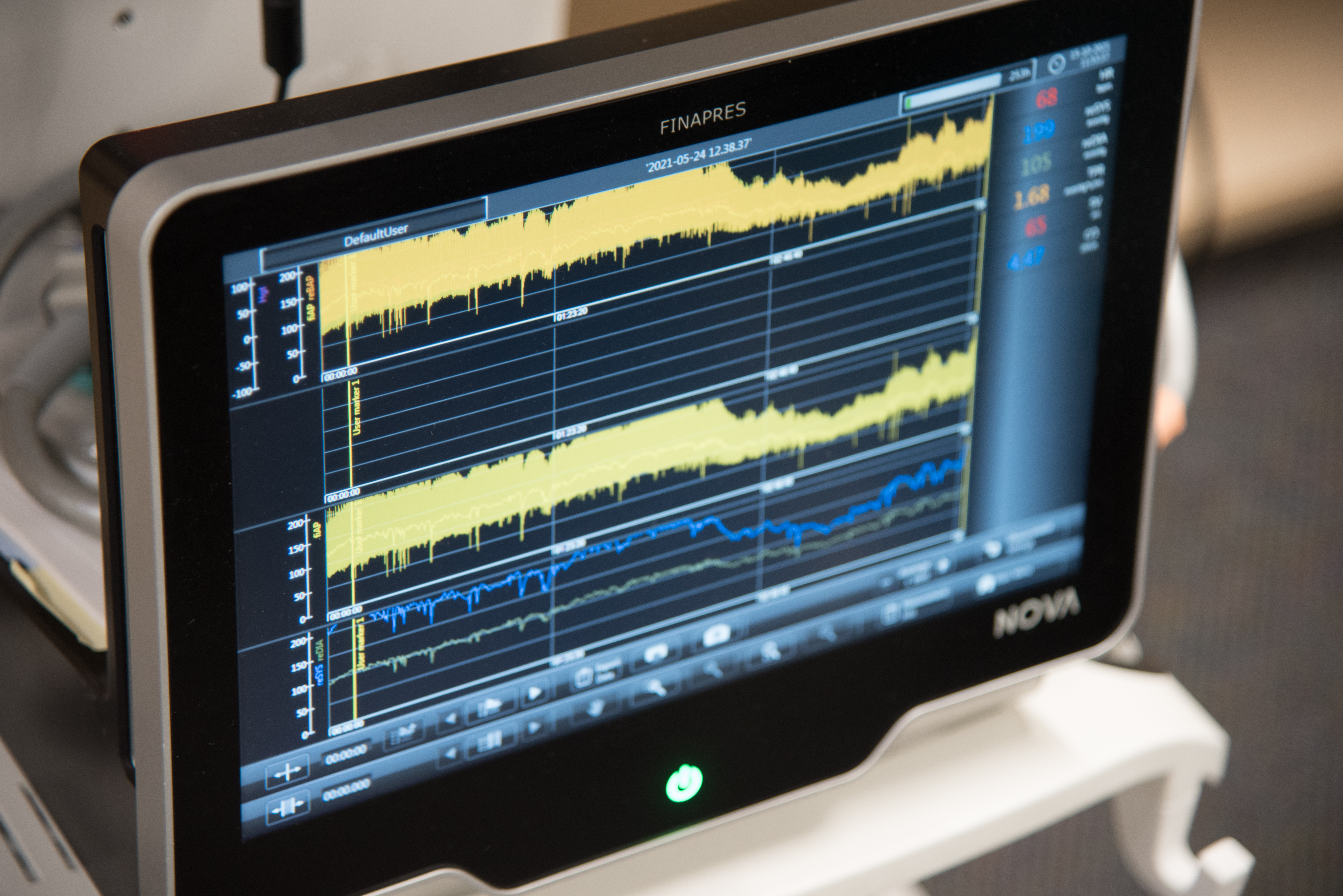 Kidney monitoring