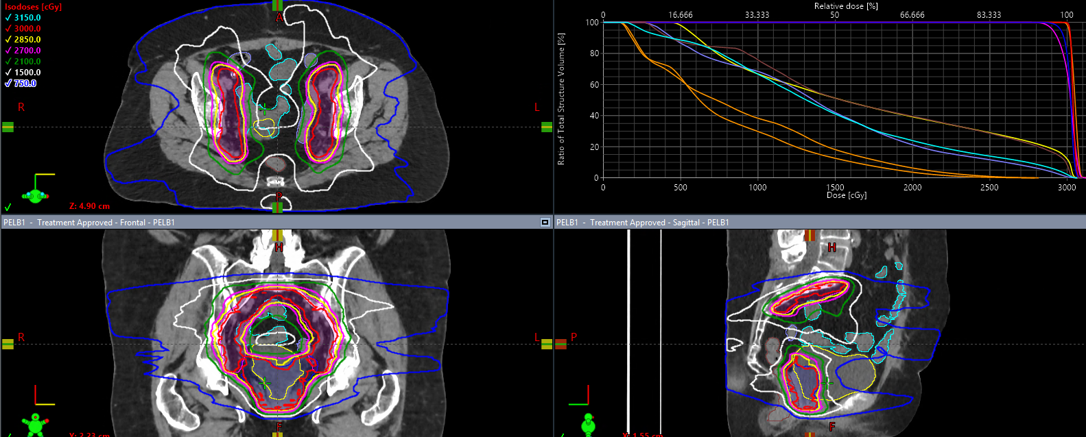 Uterine scan